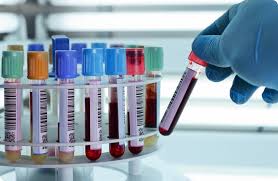 Blood Tests