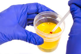 Urine Test