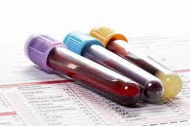 Routine Blood Test