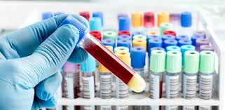 Pathology and diagnostics lab tests with home sample collection Delhi NCR