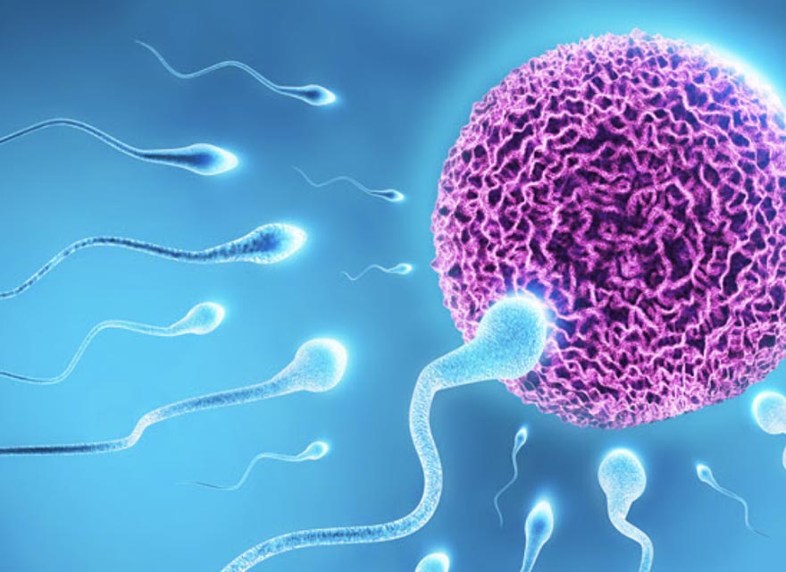 Infertility PCOS treatment Delhi