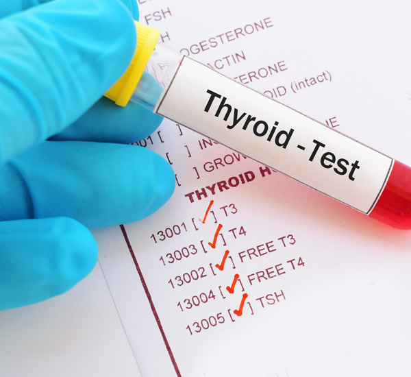 Thyroid test in Malviya Nagar