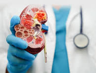 Acute and chronic kidney disease treatment Malviya Nagar Delhi