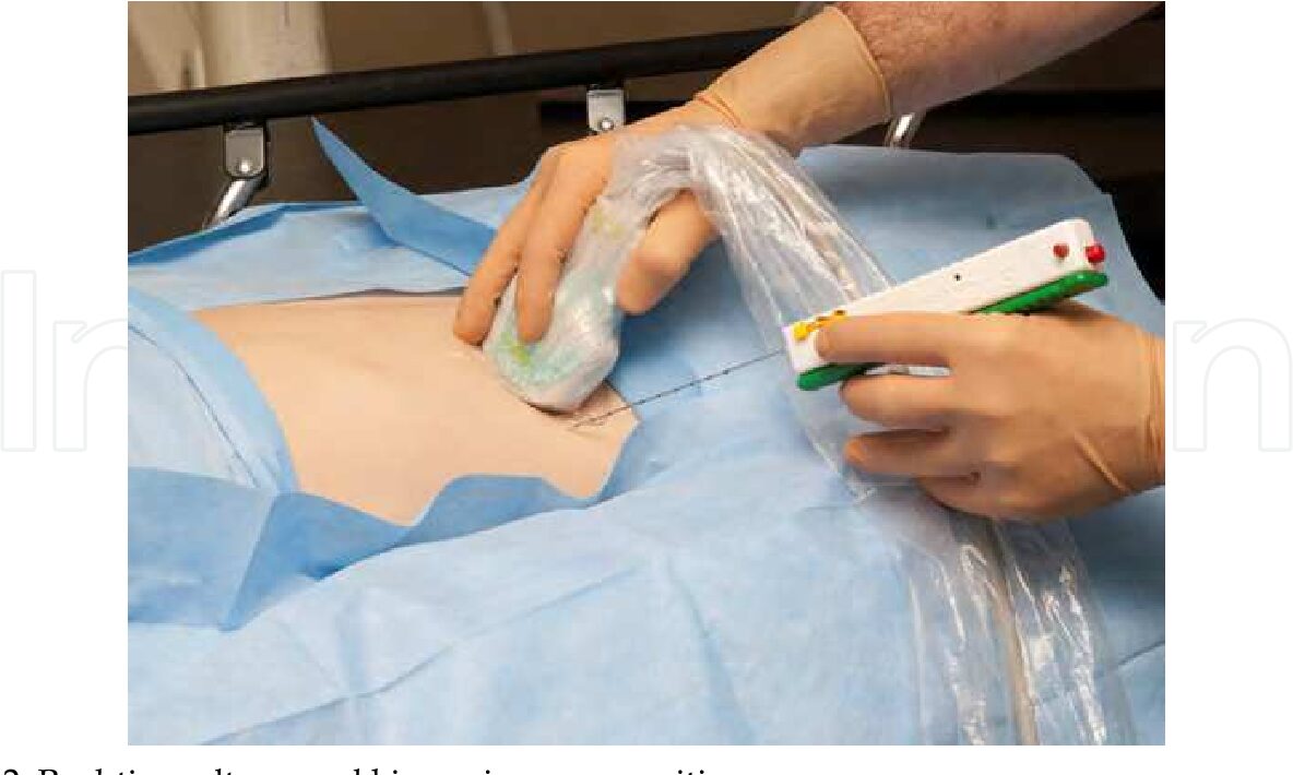 Renal biopsy diagnosis Delhi