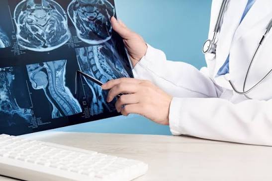 Brain MRI report review by neurosurgeon in Delhi